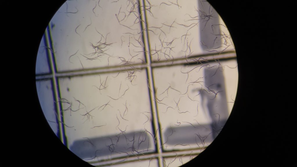 view of nematodes through a microscope